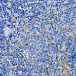 IQGAP1 Antibody in Immunohistochemistry (Paraffin) (IHC (P))