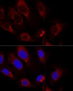 Citrate Synthase Antibody in Immunocytochemistry (ICC/IF)