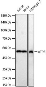 ATP Synthase beta Antibody in Western Blot (WB)