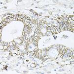 ATP1B1 Antibody in Immunohistochemistry (Paraffin) (IHC (P))