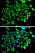 APOBEC3C Antibody in Immunocytochemistry (ICC/IF)