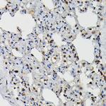 PRPF4 Antibody in Immunohistochemistry (Paraffin) (IHC (P))