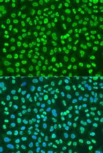 PTBP1 Antibody in Immunocytochemistry (ICC/IF)