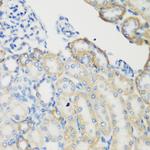 TGM5 Antibody in Immunohistochemistry (Paraffin) (IHC (P))