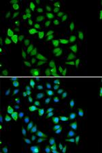 STAMBP Antibody in Immunocytochemistry (ICC/IF)