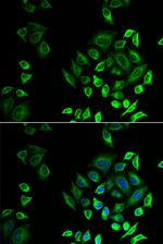 PLA2G2D Antibody in Immunocytochemistry (ICC/IF)