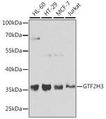 GTF2H3 Antibody in Western Blot (WB)