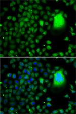 TAF5 Antibody in Immunocytochemistry (ICC/IF)