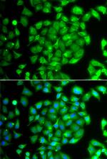 MOX1 Antibody in Immunocytochemistry (ICC/IF)