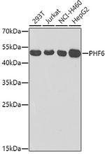 PHF6 Antibody in Western Blot (WB)