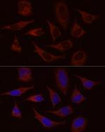 STIM1 Antibody in Immunocytochemistry (ICC/IF)