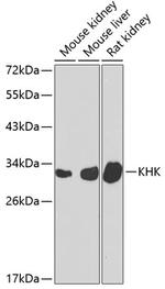 KHK Antibody in Western Blot (WB)