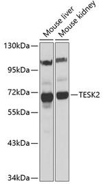 TESK2 Antibody in Western Blot (WB)