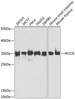 HCCS Antibody in Western Blot (WB)