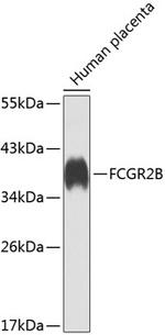 CD32b Antibody in Western Blot (WB)