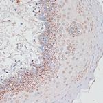 Desmoplakin Antibody in Immunohistochemistry (Paraffin) (IHC (P))