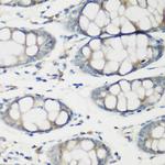 TNNC2 Antibody in Immunohistochemistry (Paraffin) (IHC (P))