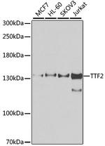 TTF2 Antibody in Western Blot (WB)