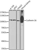 CDH16 Antibody in Western Blot (WB)