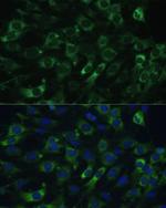 EEF1G Antibody in Immunocytochemistry (ICC/IF)