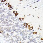 EEF1G Antibody in Immunohistochemistry (Paraffin) (IHC (P))