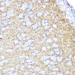 CD56 Antibody in Immunohistochemistry (Paraffin) (IHC (P))