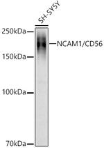 CD56 Antibody in Western Blot (WB)