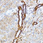 MYLK Antibody in Immunohistochemistry (Paraffin) (IHC (P))