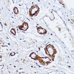 MYLK Antibody in Immunohistochemistry (Paraffin) (IHC (P))