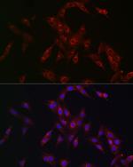 MR1 Antibody in Immunocytochemistry (ICC/IF)