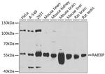 RAB3IP Antibody in Western Blot (WB)