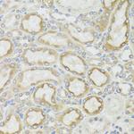 MT-ND5 Antibody in Immunohistochemistry (Paraffin) (IHC (P))