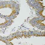 MT-ND5 Antibody in Immunohistochemistry (Paraffin) (IHC (P))