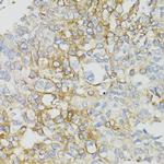 MT-ND5 Antibody in Immunohistochemistry (Paraffin) (IHC (P))