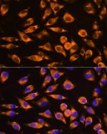 CEP55 Antibody in Immunocytochemistry (ICC/IF)