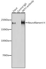 NF-H Antibody in Immunoprecipitation (IP)