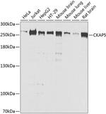 CKAP5 Antibody in Western Blot (WB)