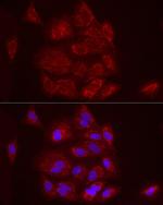 FCGRT Antibody in Immunocytochemistry (ICC/IF)