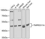 TMPRSS11A Antibody in Western Blot (WB)