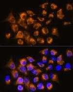 beta-3 Adrenergic Receptor Antibody in Immunocytochemistry (ICC/IF)