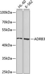 beta-3 Adrenergic Receptor Antibody in Western Blot (WB)