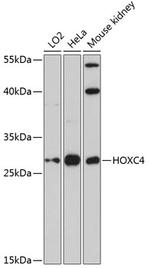 HOXC4 Antibody in Western Blot (WB)