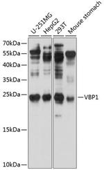 VBP1 Antibody in Western Blot (WB)