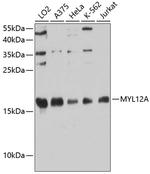 MYL12A Antibody in Western Blot (WB)