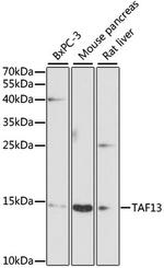 TAF13 Antibody in Western Blot (WB)