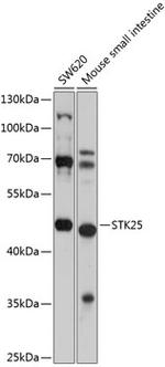 STK25 Antibody in Western Blot (WB)