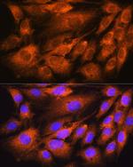 ATP5D Antibody in Immunocytochemistry (ICC/IF)