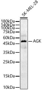 AGK Antibody in Western Blot (WB)