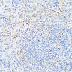 MNF1 Antibody in Immunohistochemistry (Paraffin) (IHC (P))