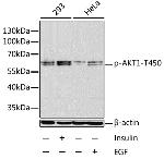 Phospho-AKT1 (Thr450) Antibody in Western Blot (WB)